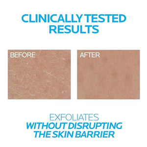 La Roche-Posay Lipikar Urea 10% Roughness Smoothing Lotion