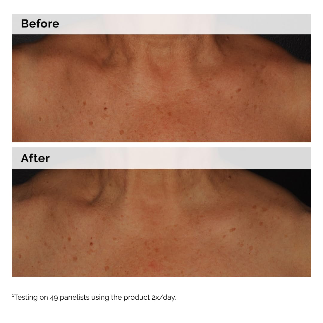 The Ordinary Niacinamide 5% Face and Body Emulsion