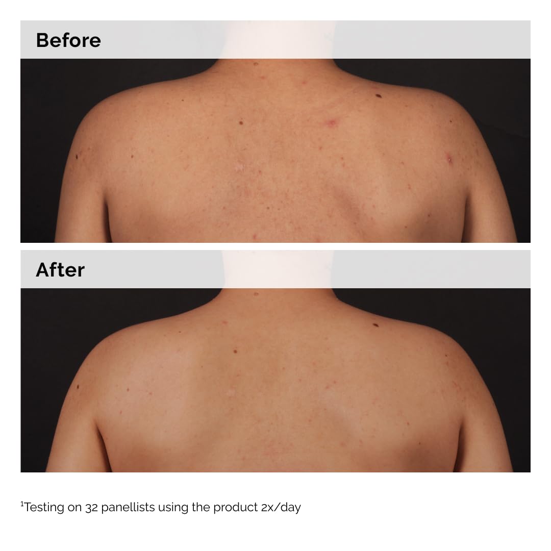 The Ordinary Salicylic Acid 0.5% Body Serum