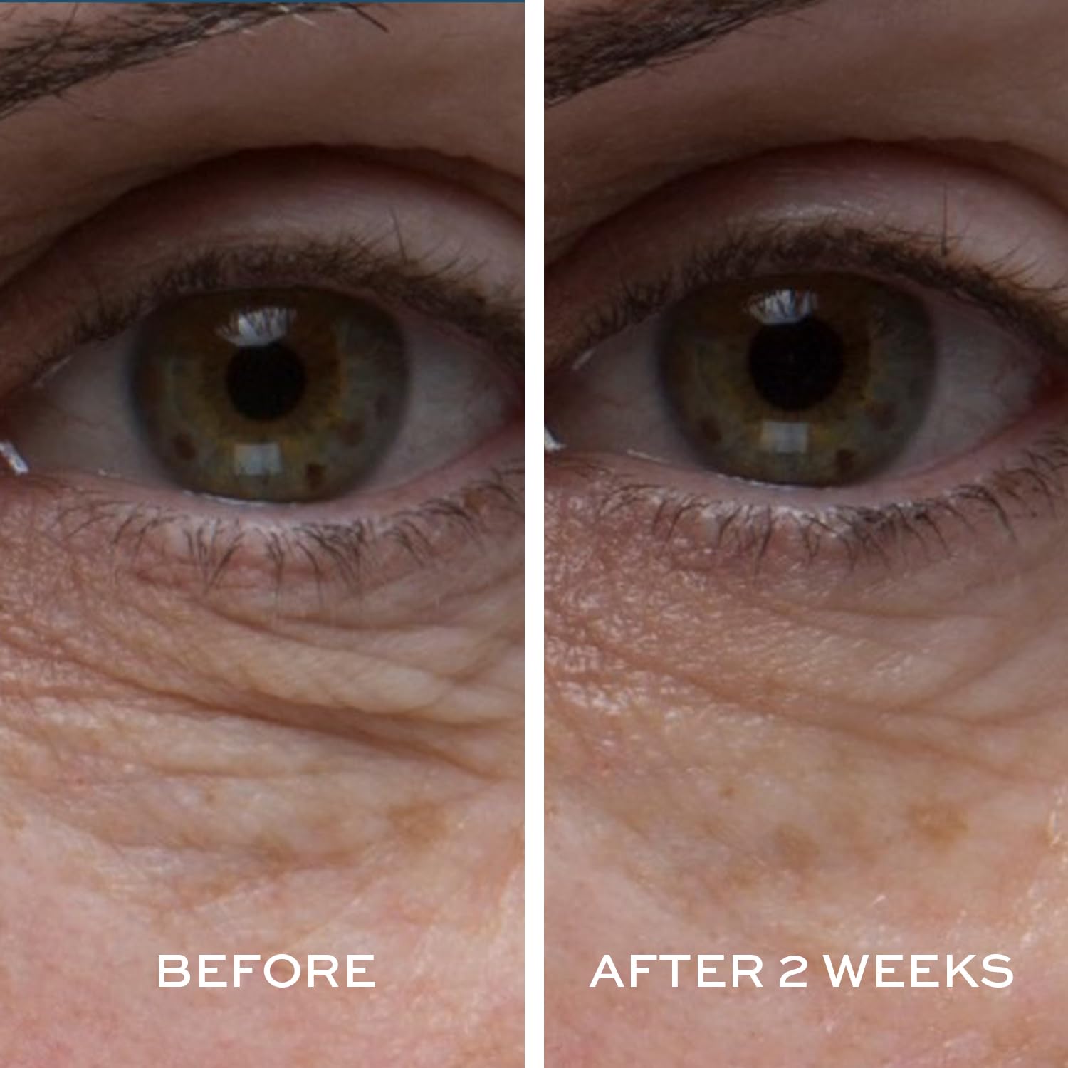 ELEMIS Peptide4 Eye Recovery Cream