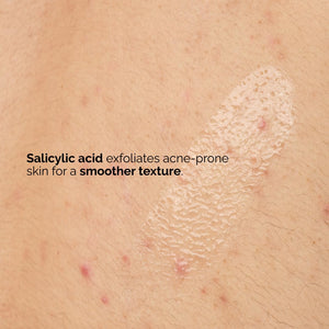 The Ordinary Salicylic Acid 0.5% Body Serum