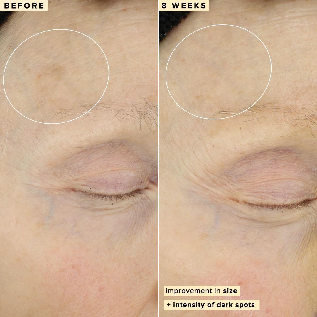 Farmacy 10% Vitamin C Face Serum