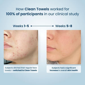 Clean Skin Club Clean Towels XL™, 100 Ct, 2 Pack