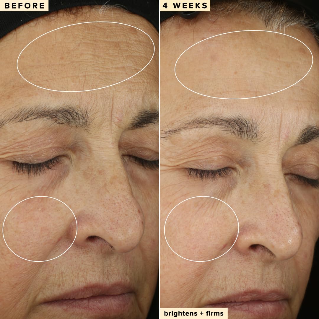 Farmacy 10% Vitamin C Face Serum