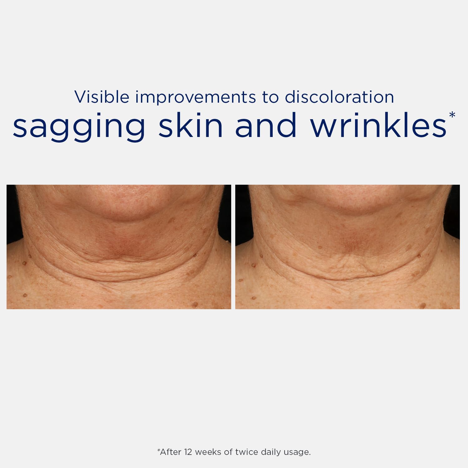 NEOSTRATA Triple Firming Neck Cream