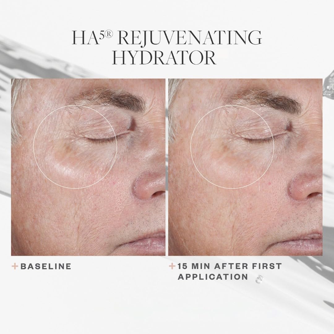 SkinMedica HA5 Rejuvenating Hydrator Hyaluronic Acid Serum