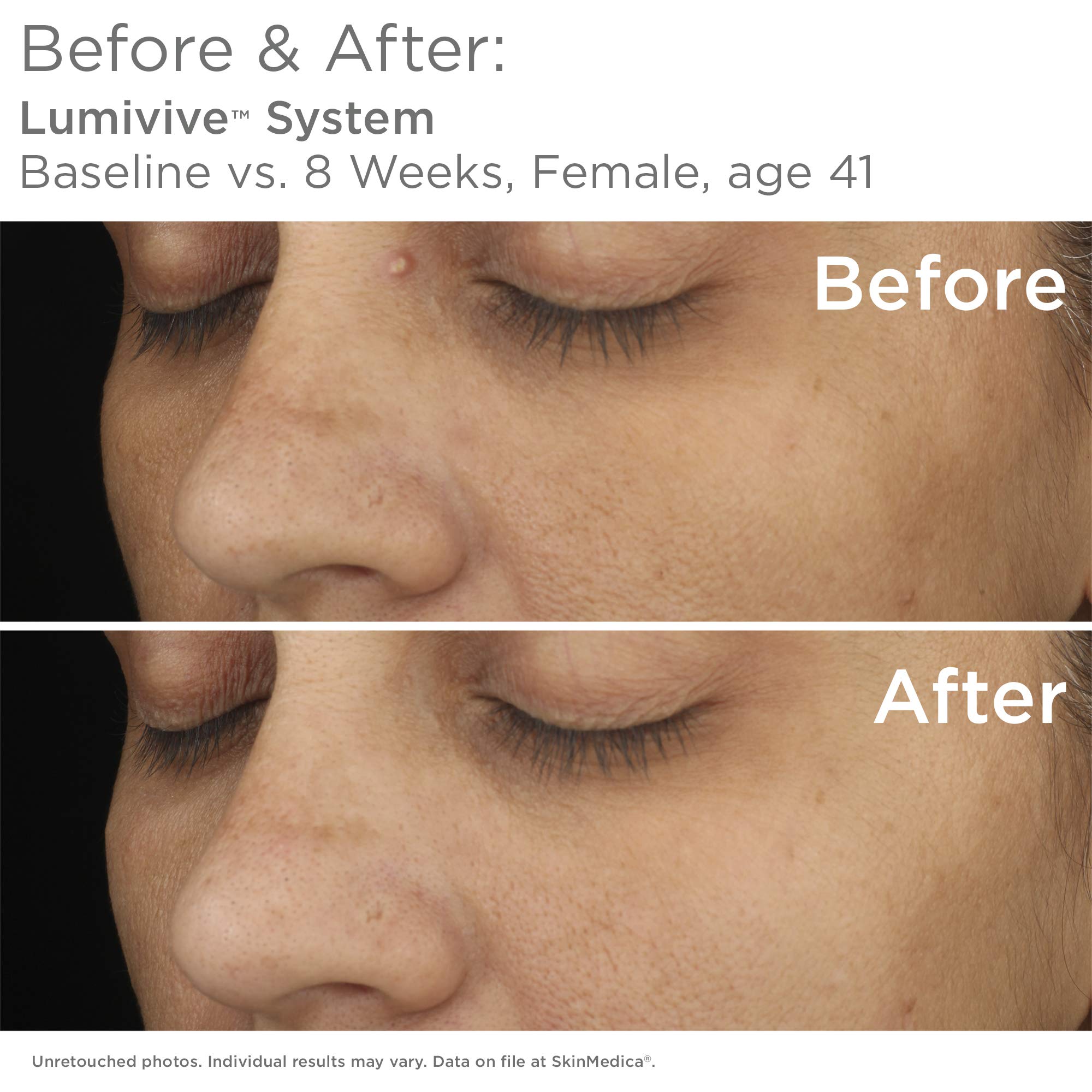 SkinMedica Lumivive Day & Night System