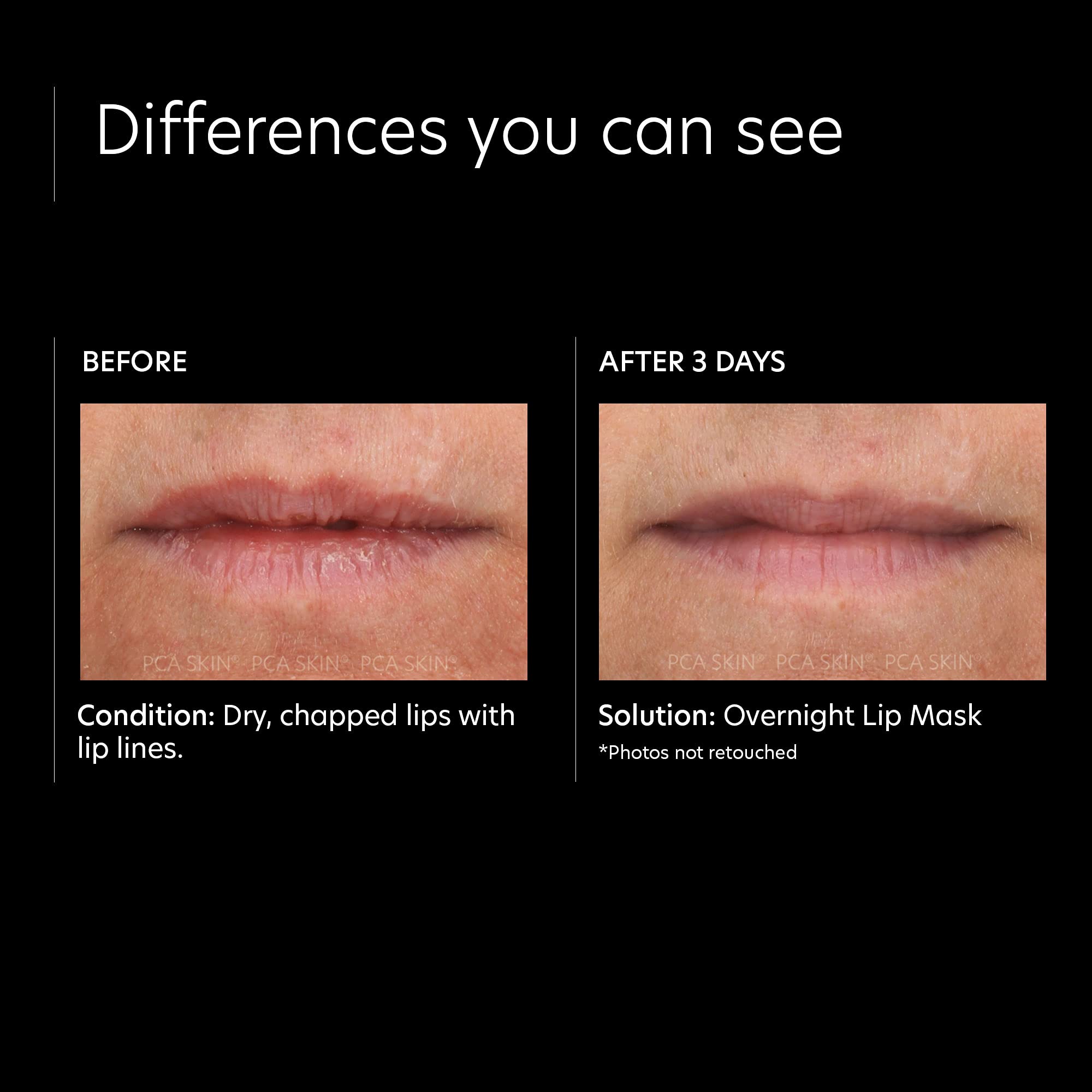 PCA SKIN Overnight Lip Balm Mask