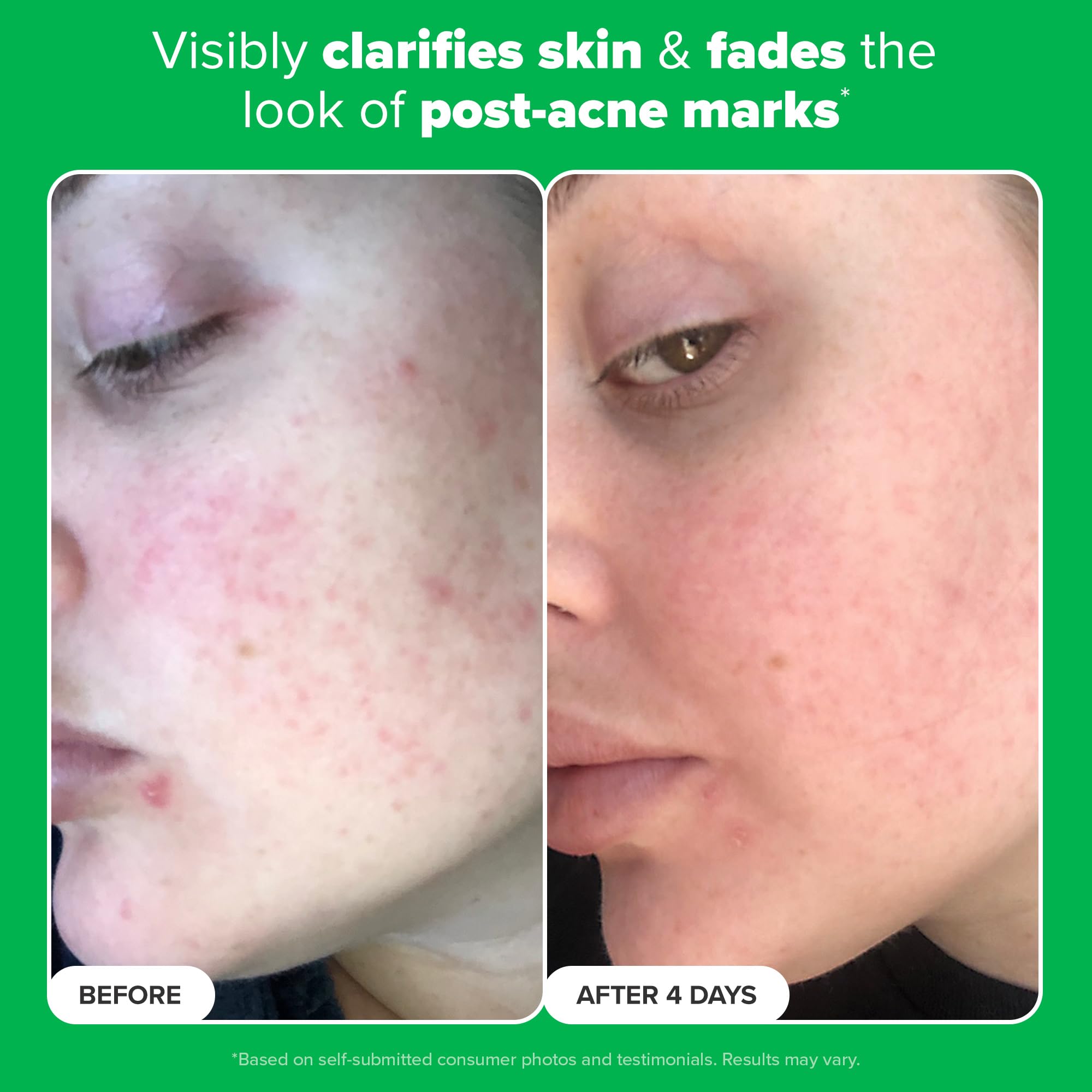 Paula's Choice BOOST 10% Azelaic Acid Booster Cream Gel