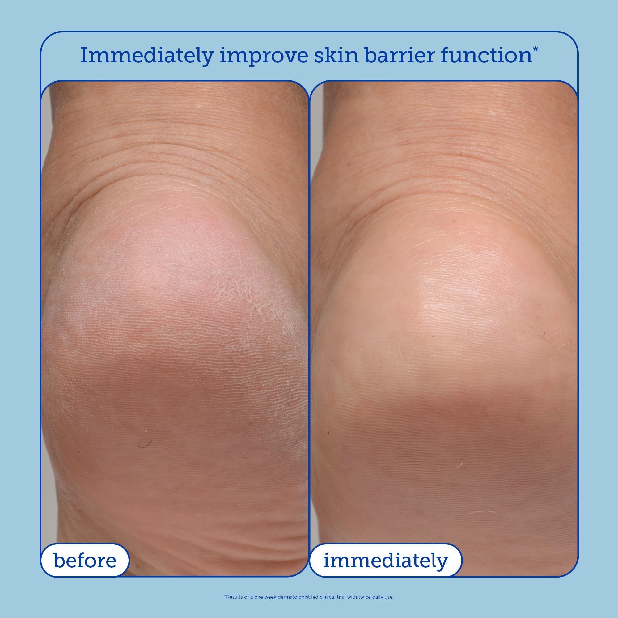 Skinfix Remedy+ 911 Ointment Multipurpose Healing Balm