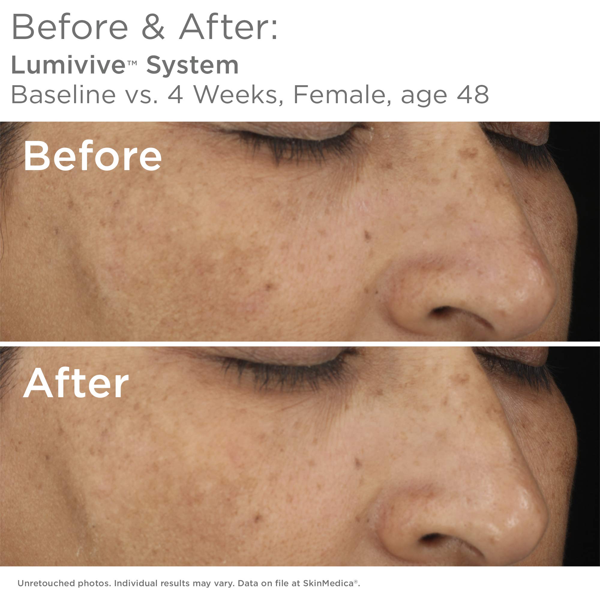 SkinMedica Lumivive Day & Night System