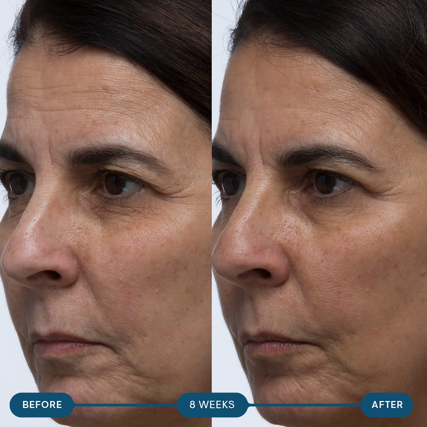 ELEMIS Pro-Collagen Skin Future Supplements