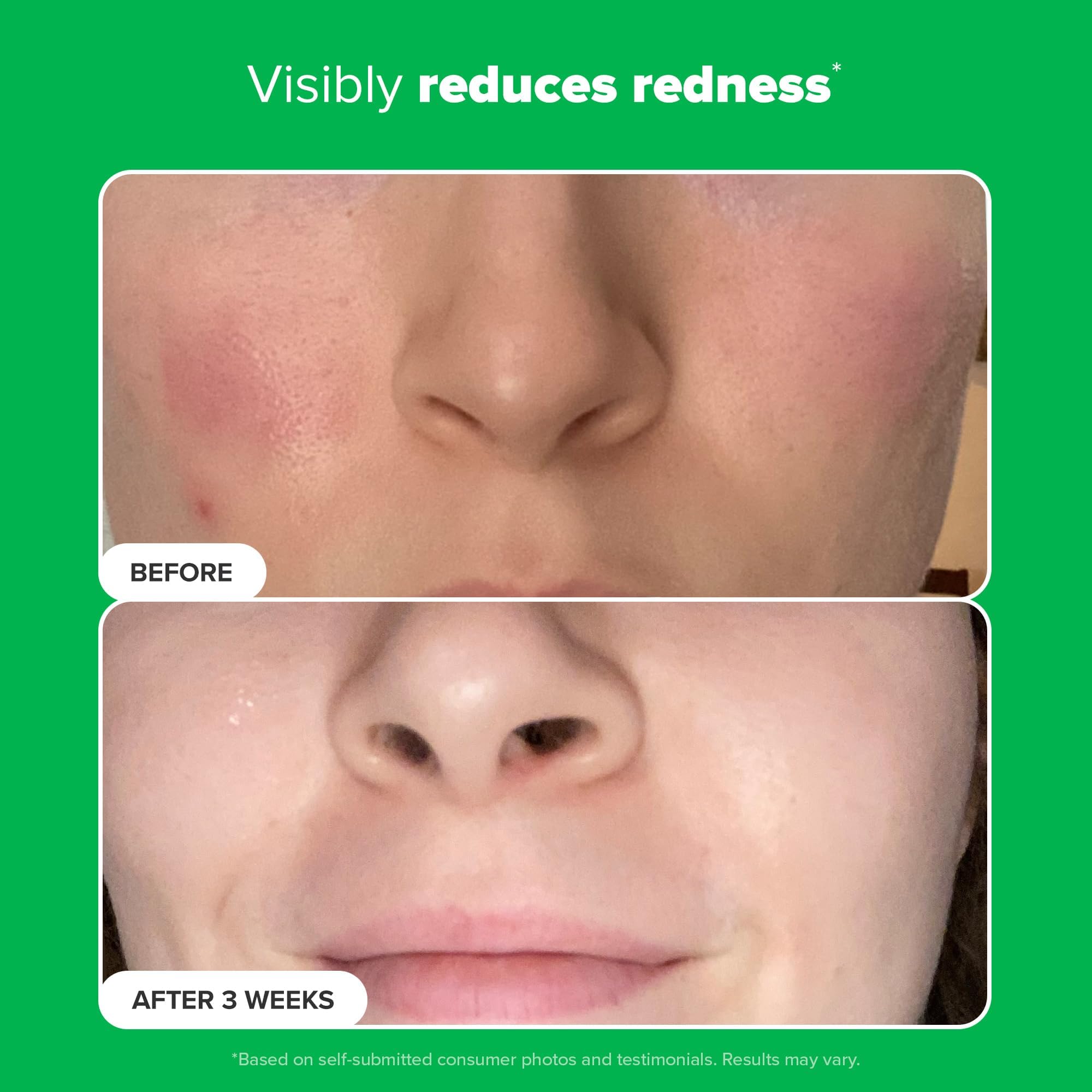 Paula's Choice BOOST 10% Azelaic Acid Booster Cream Gel