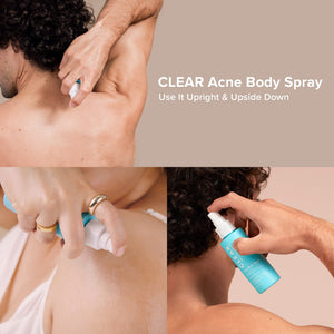Paula's Choice CLEAR Back & Body Exfoliating Acne Spray