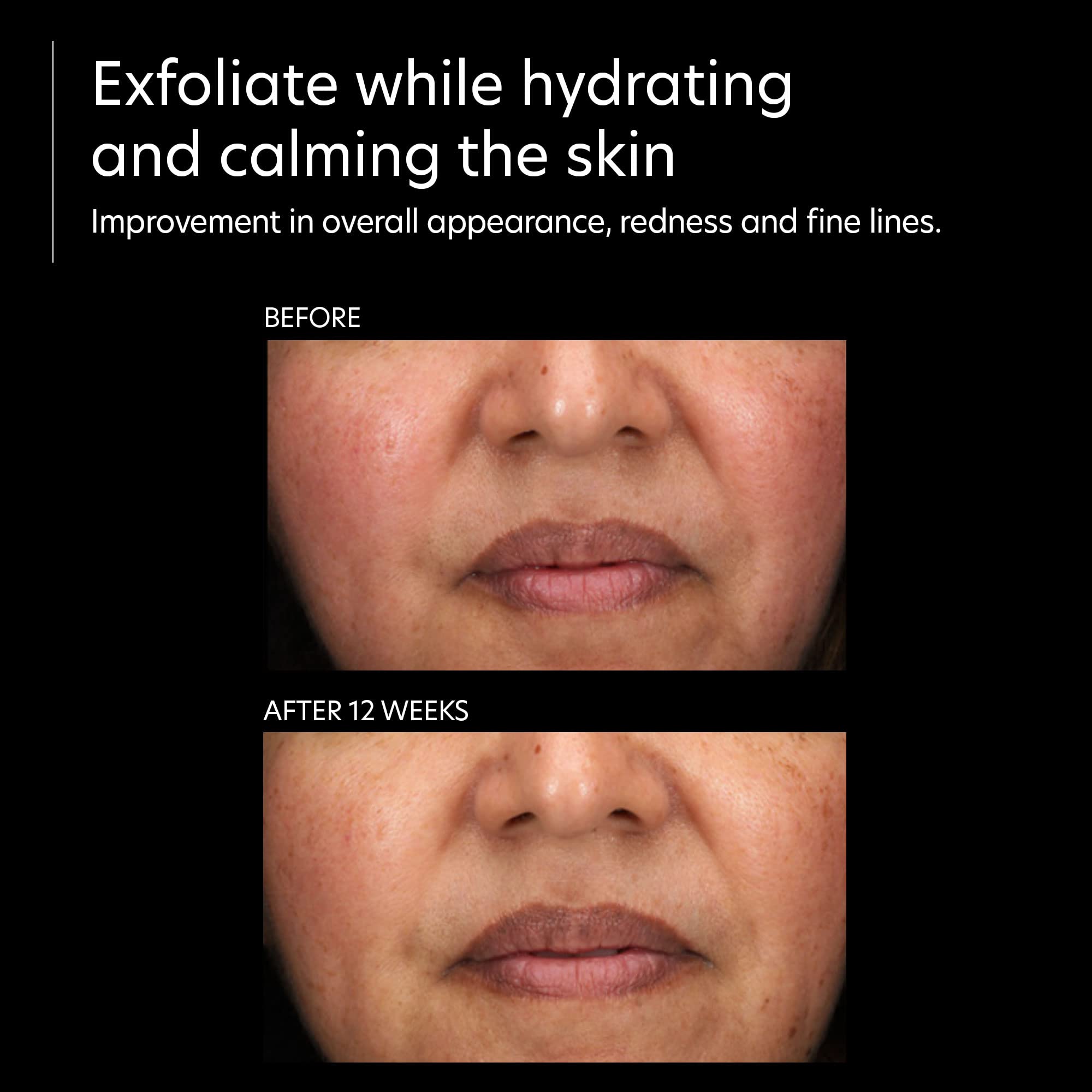 PCA SKIN Resurfacing Serum