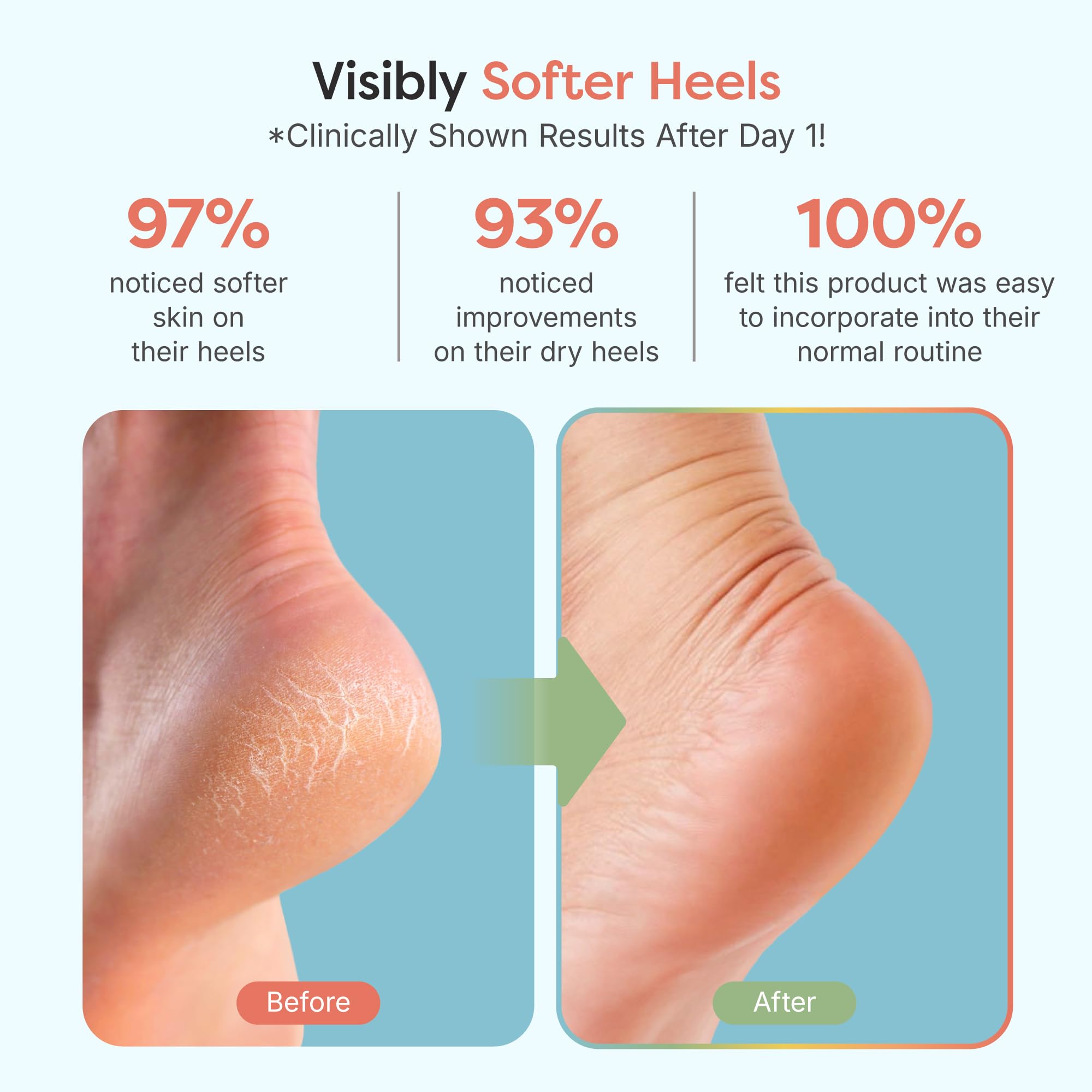 ZenToes Moisturizing Socks for Cracked Heel Treatment