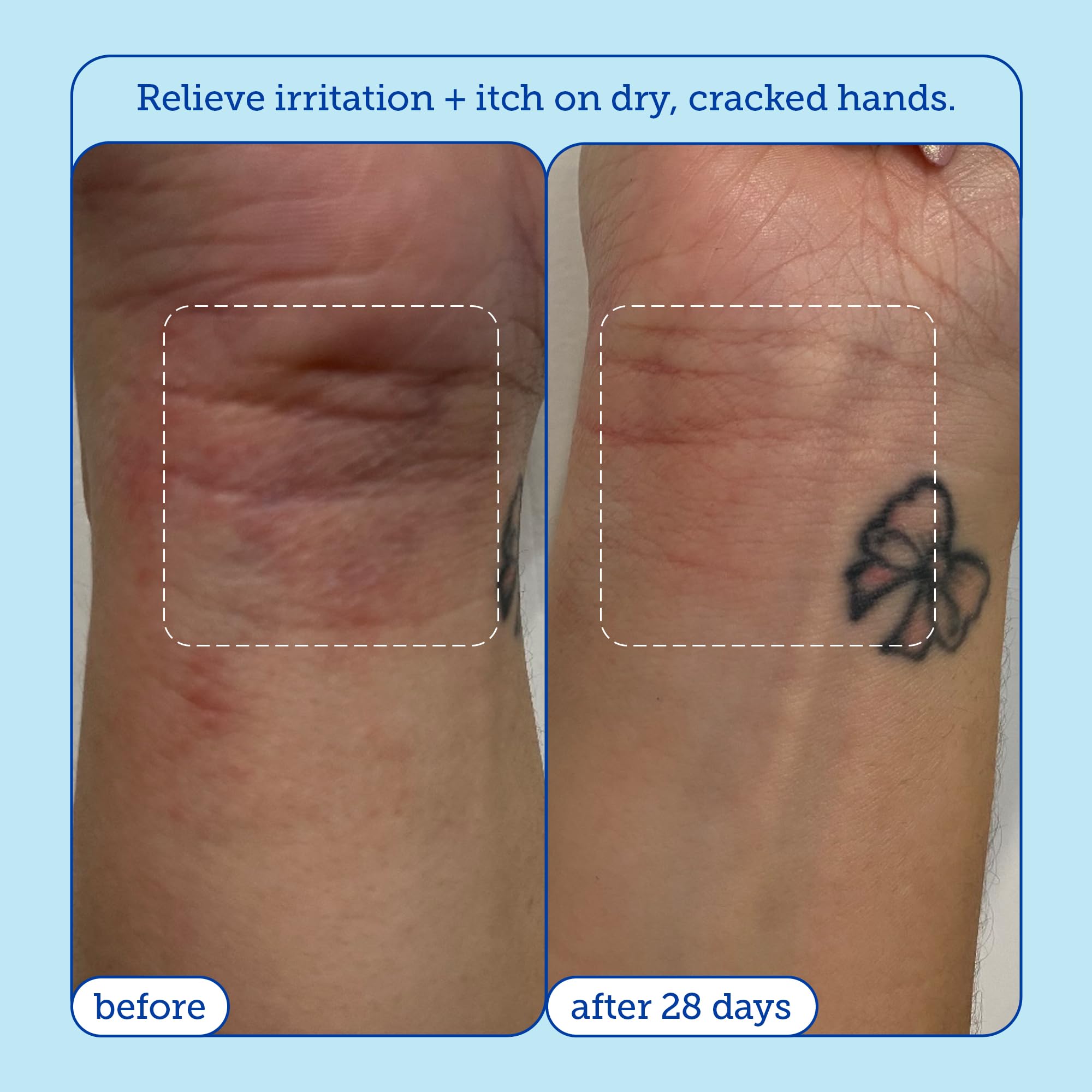 Skinfix Eczema+ Hand Relief Cream