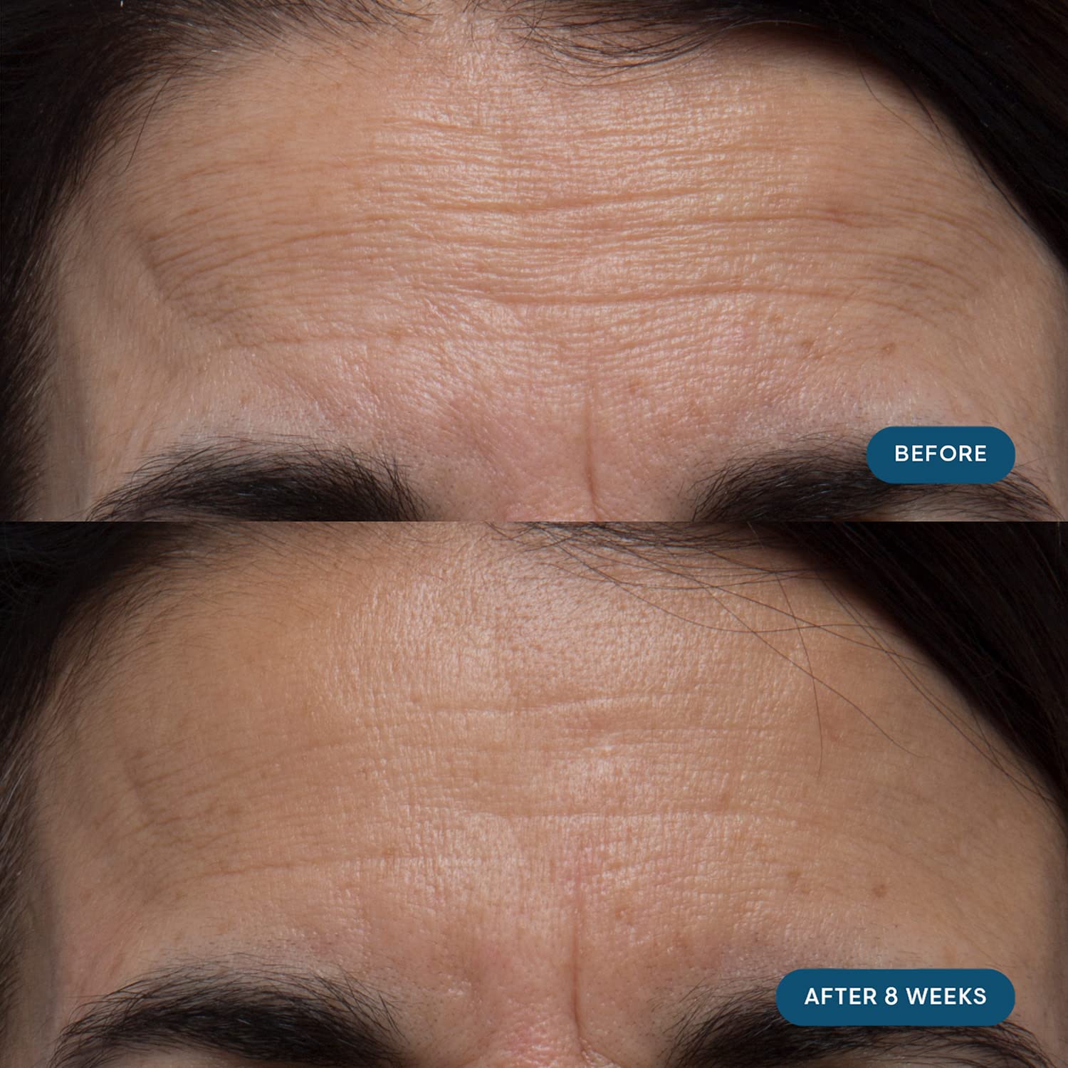 ELEMIS Pro-Collagen Skin Future Supplements