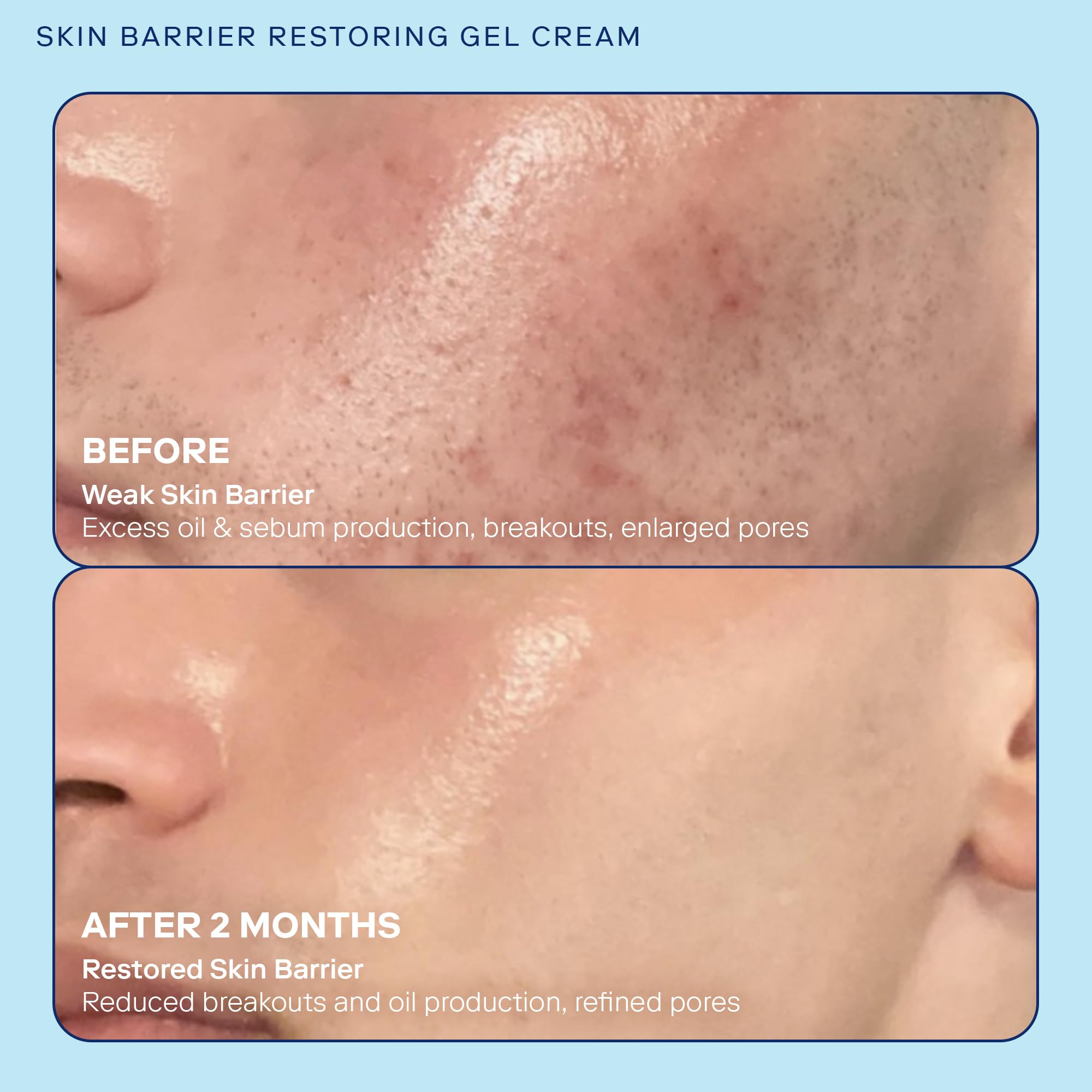 Skinfix Skin Barrier Restoring Gel Cream