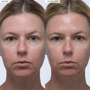 Glow Recipe Plum Plumping & Hydrating Hyaluronic Acid Serum