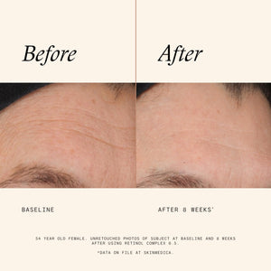 SkinMedica Retinol 0.5 Complex - Retinol Serum