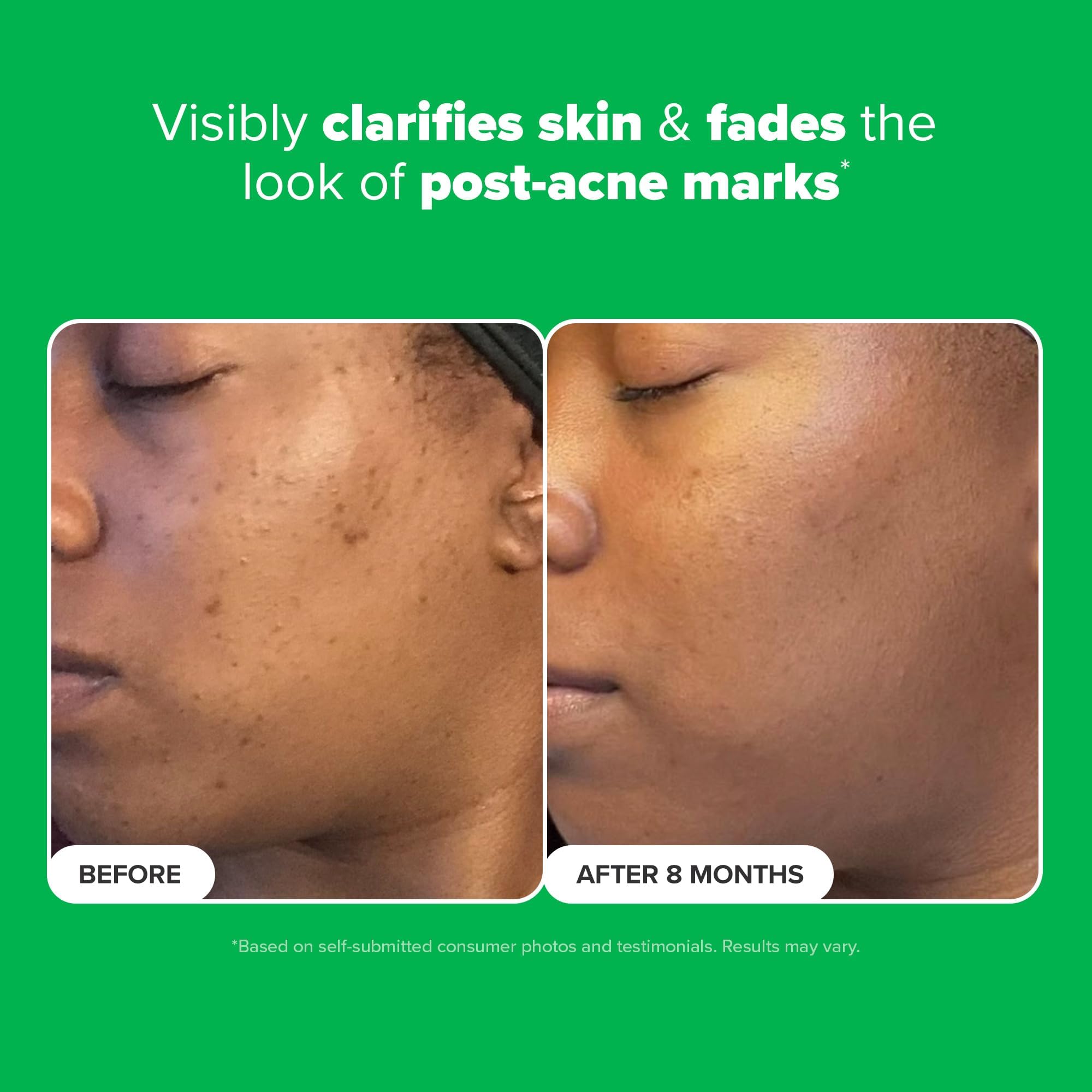 Paula's Choice BOOST 10% Azelaic Acid Booster Cream Gel