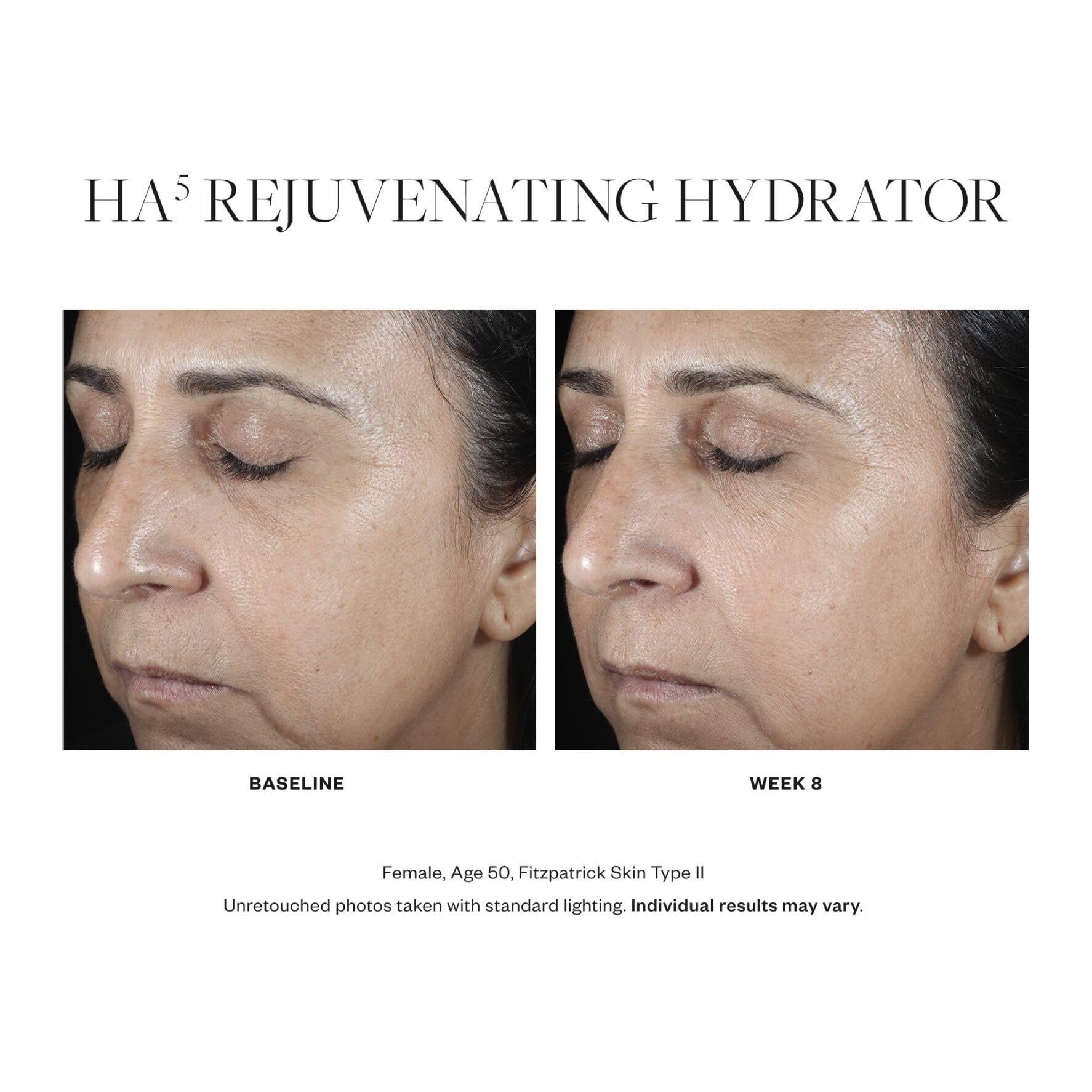 SkinMedica HA5 Rejuvenating Hydrator Hyaluronic Acid Serum