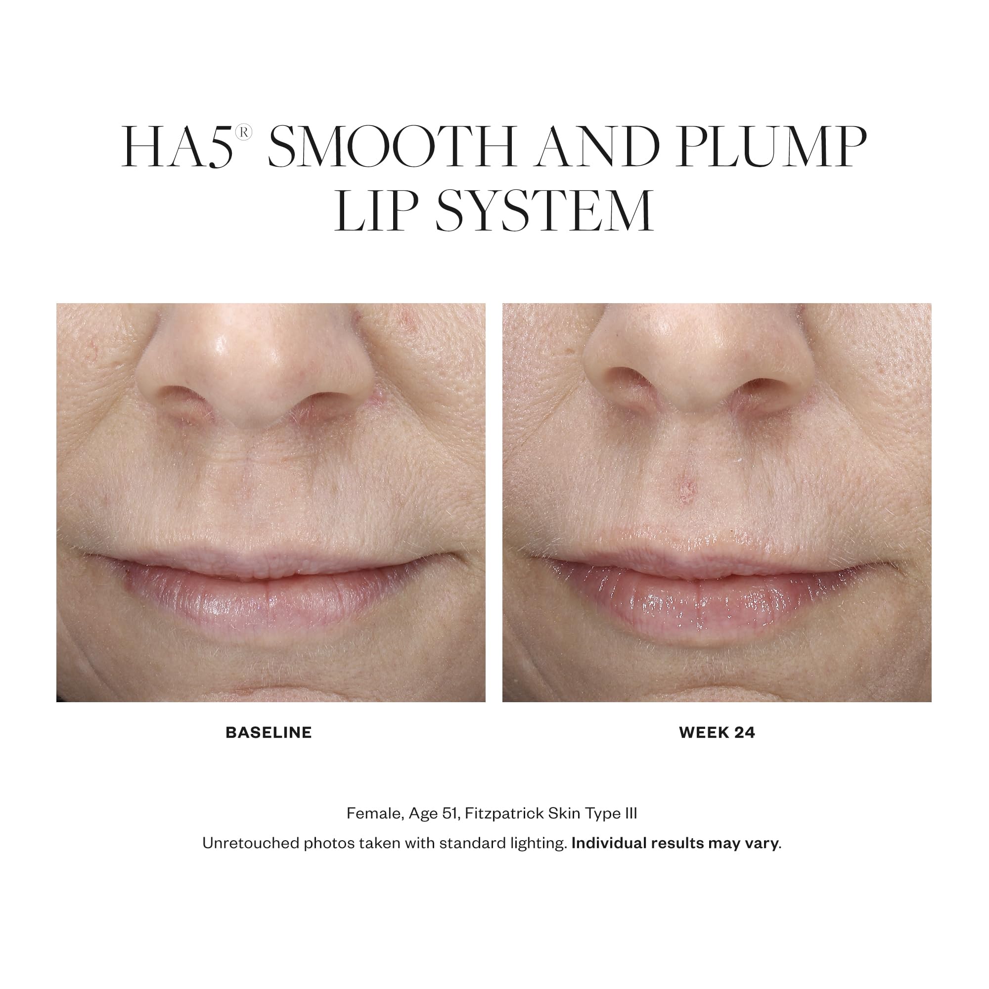 SkinMedica HA5 Smooth & Plump Lip System
