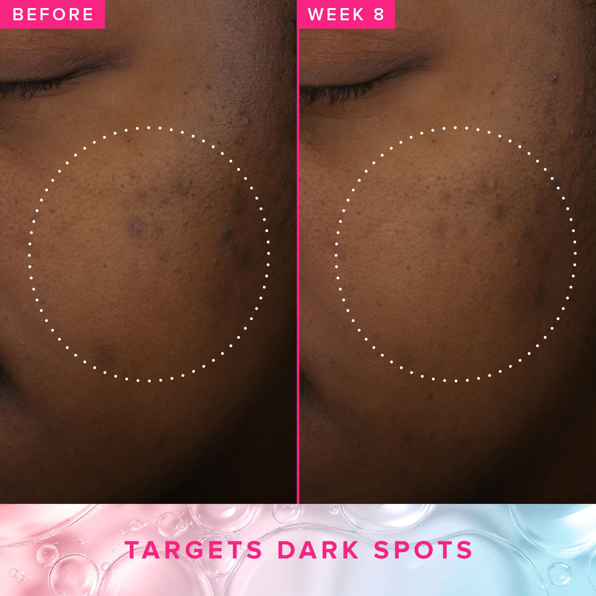 Farmacy 3% TXA Toner