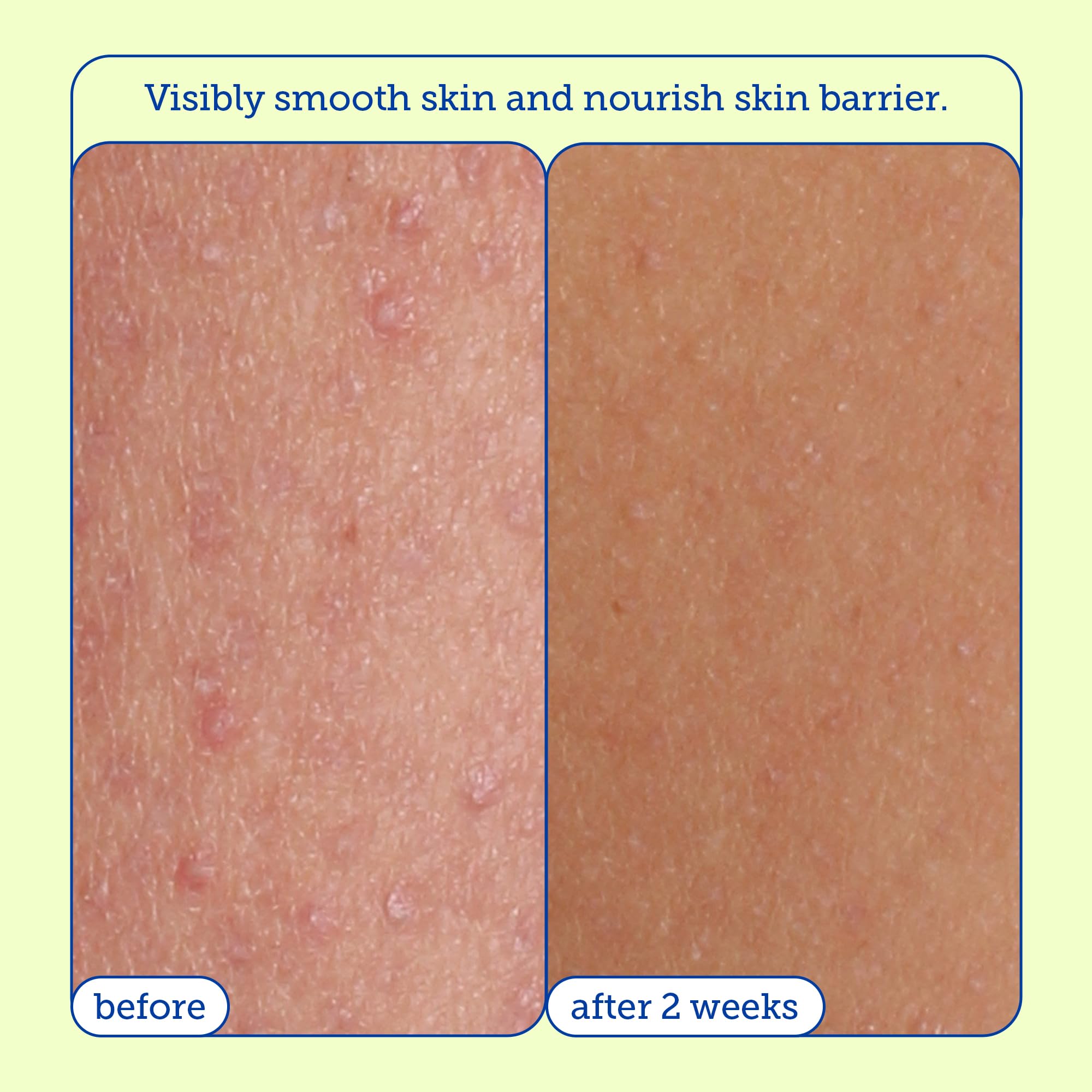 Skinfix Resurface+ AHA/BHA Renewing Cream