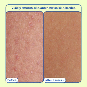 Skinfix Resurface+ AHA/BHA Renewing Cream