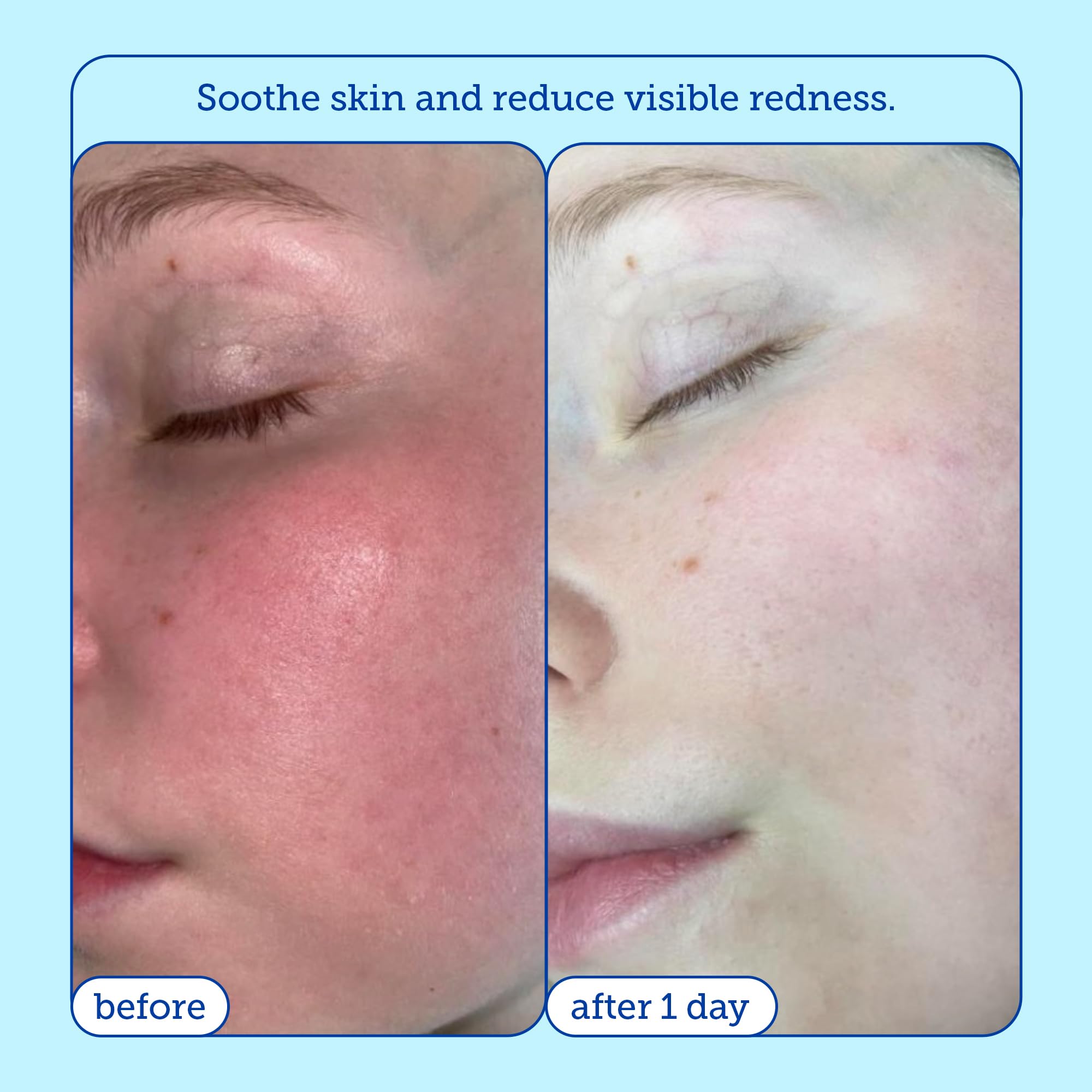 Skinfix Foaming Oil Cleanser