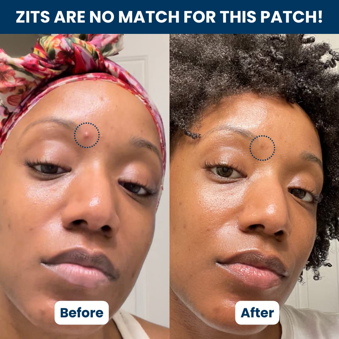 CLEAN SKIN CLUB 60 Invisible Vegan Pimple Patches