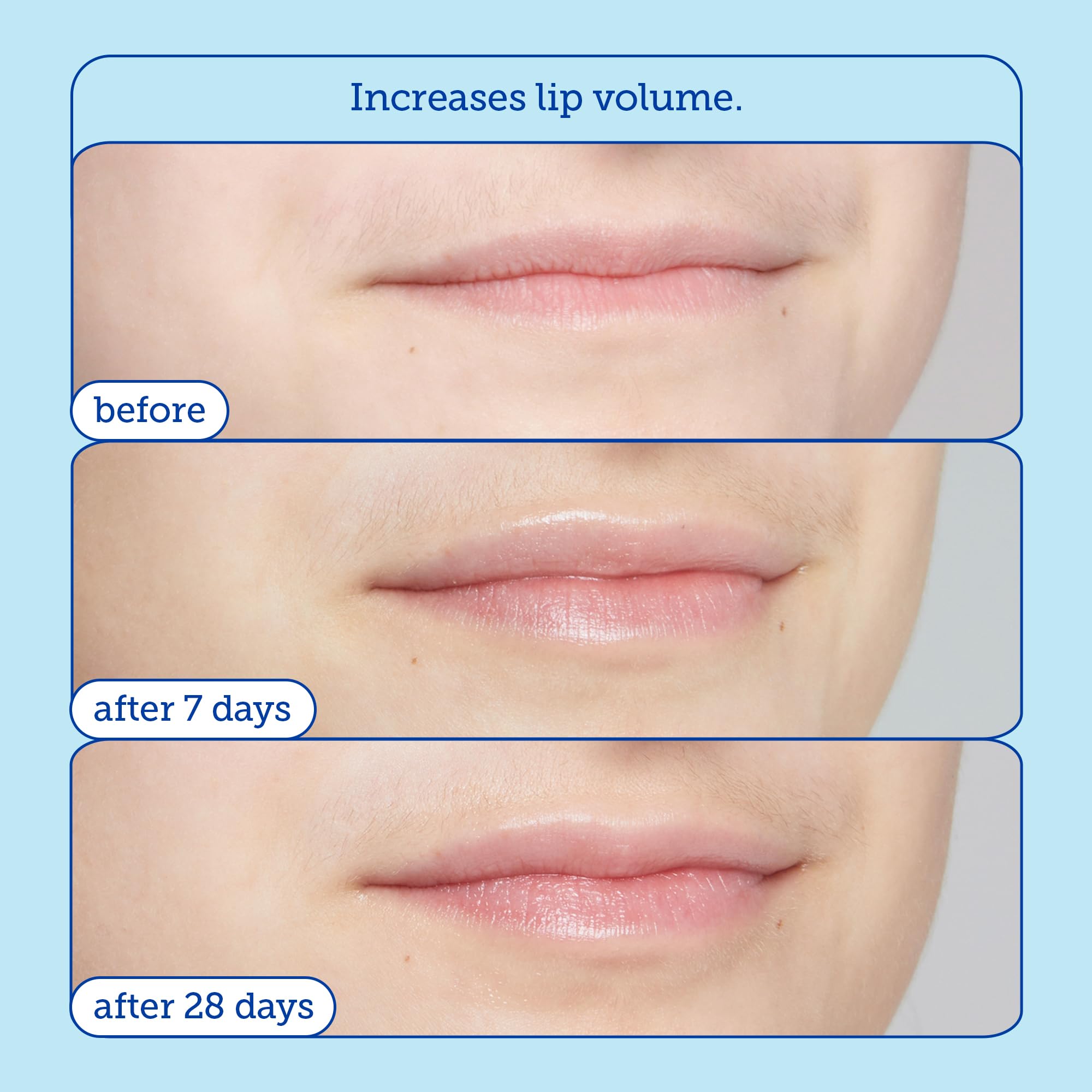 Skinfix Barrier+ Triple Lipid Lip Treatment