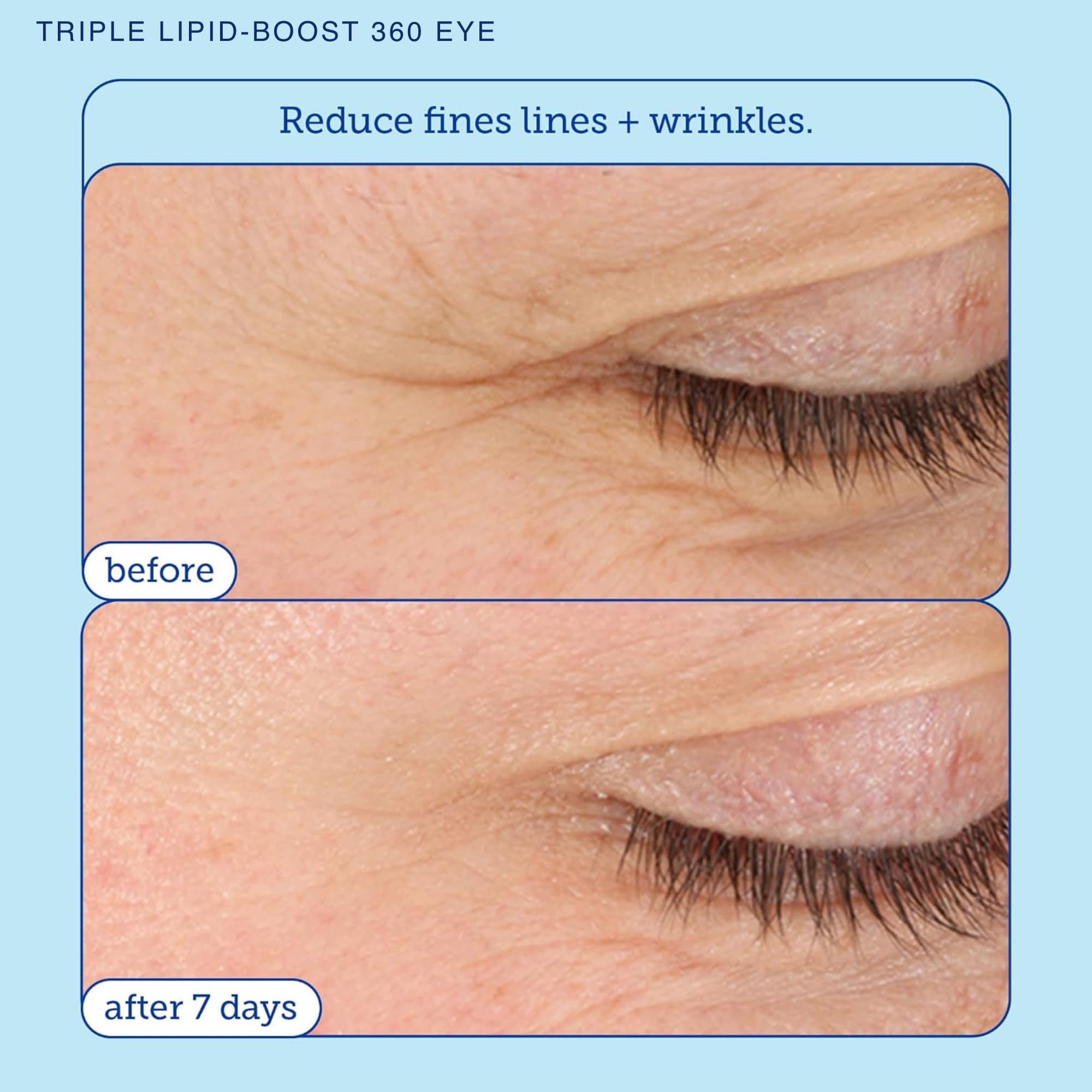 Skinfix Barrier+ Triple Lipid-Peptide Cream & Barrier+ Triple Lipid-Boost 360 Eye