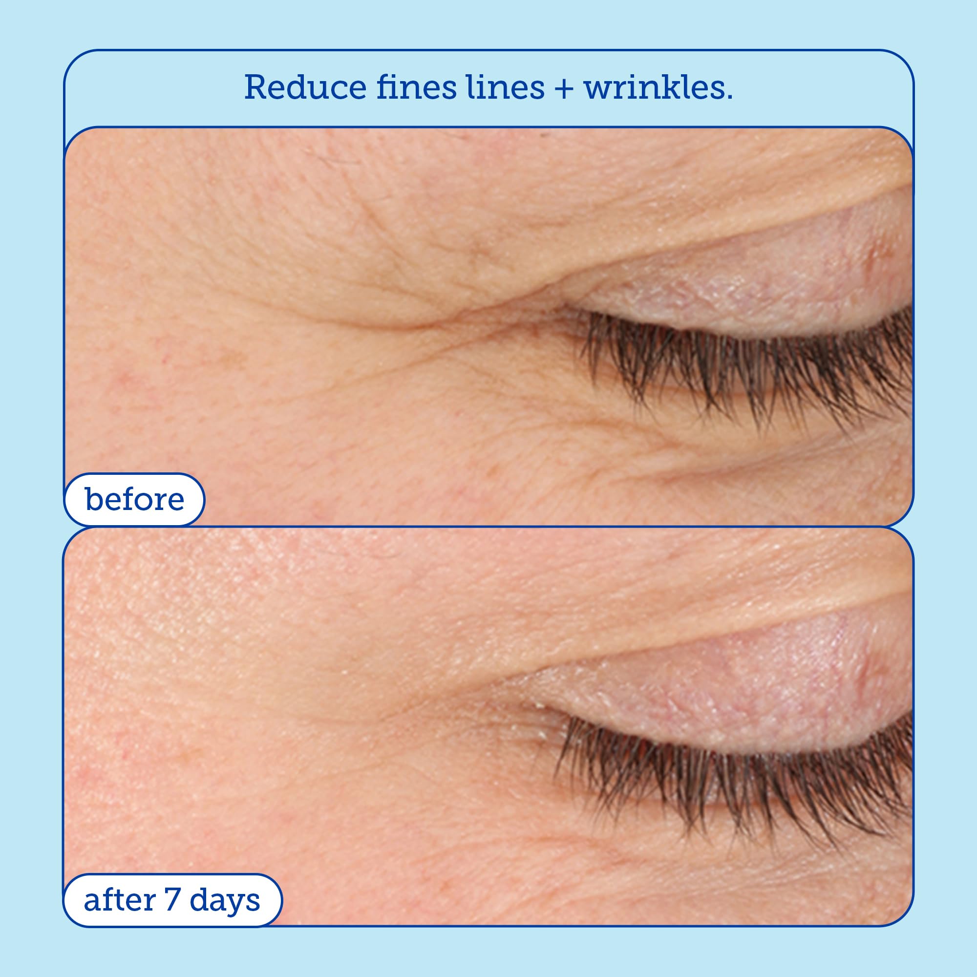 Skinfix Barrier+ Triple Lipid-Boost 360° Eye Cream