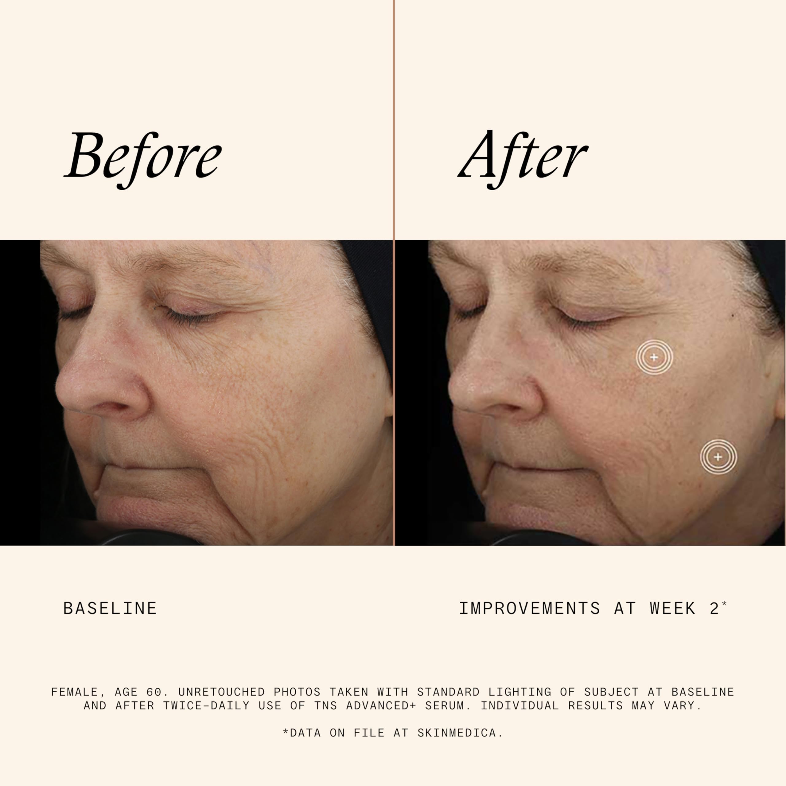 SkinMedica TNS Advanced+ Serum