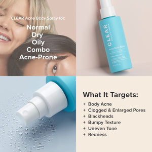 Paula's Choice CLEAR Back & Body Exfoliating Acne Spray