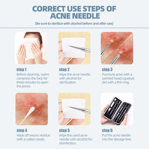 JPNK Blackhead Remover Tool Comedones Extractor Acne Removal Kit