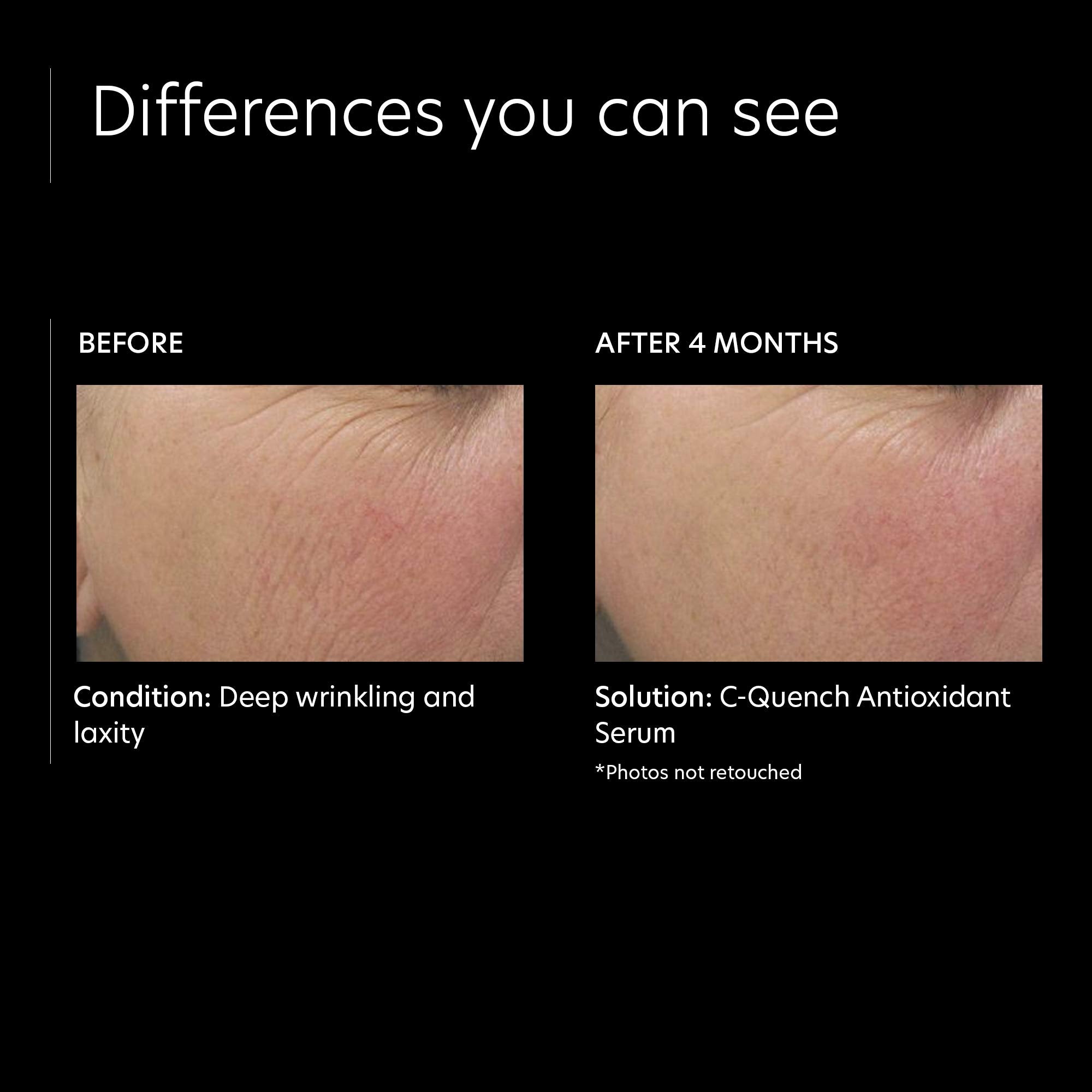 PCA SKIN Vitamin C Quench Antioxidant Protective Face Serum