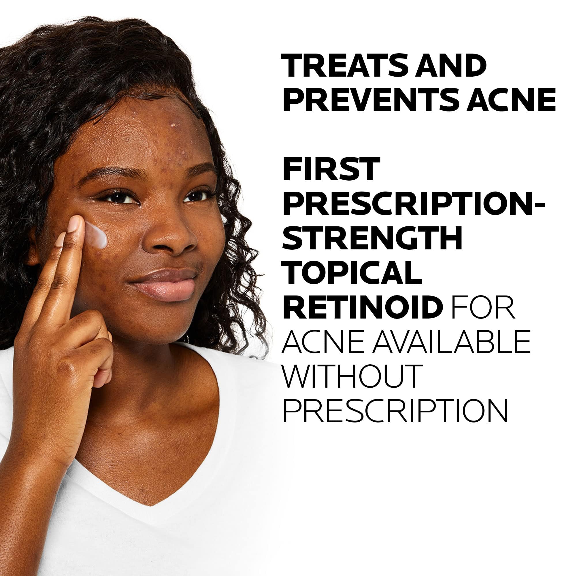 La Roche-Posay Effaclar Adapalene Gel 0.1% Acne Treatment