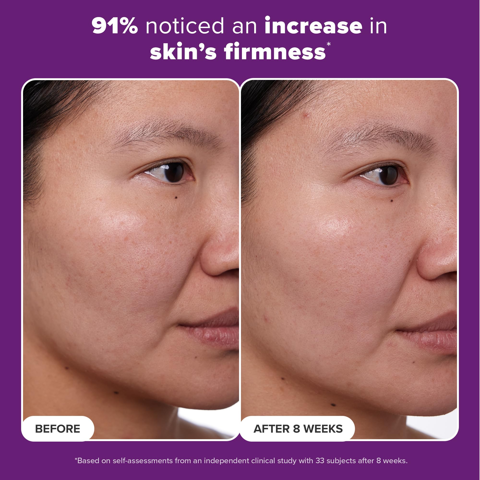 Paula's Choice CLINICAL 1% Retinol Treatment Cream