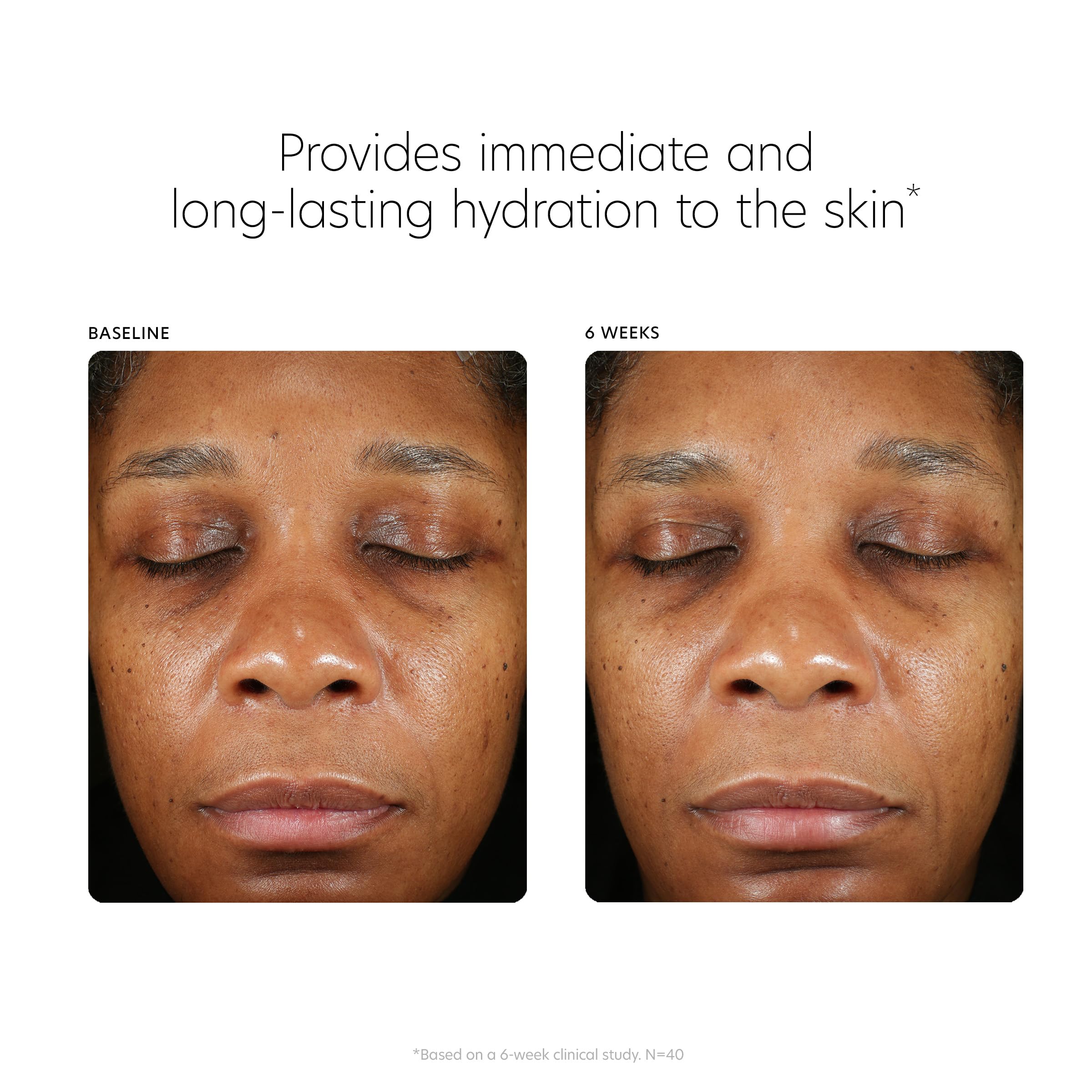 PCA SKIN Hyaluronic Acid Boosting Face Serum