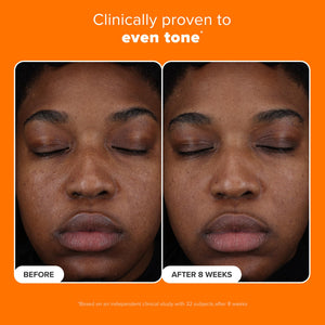 Paula’s Choice 25% Vitamin C Serum