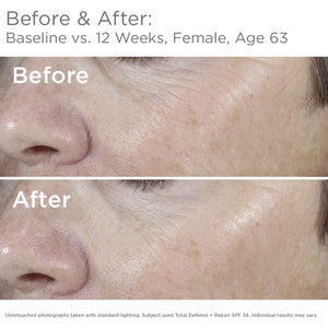 SkinMedica Total Defense + Repair SPF 34 Tinted Sunscreen for Face