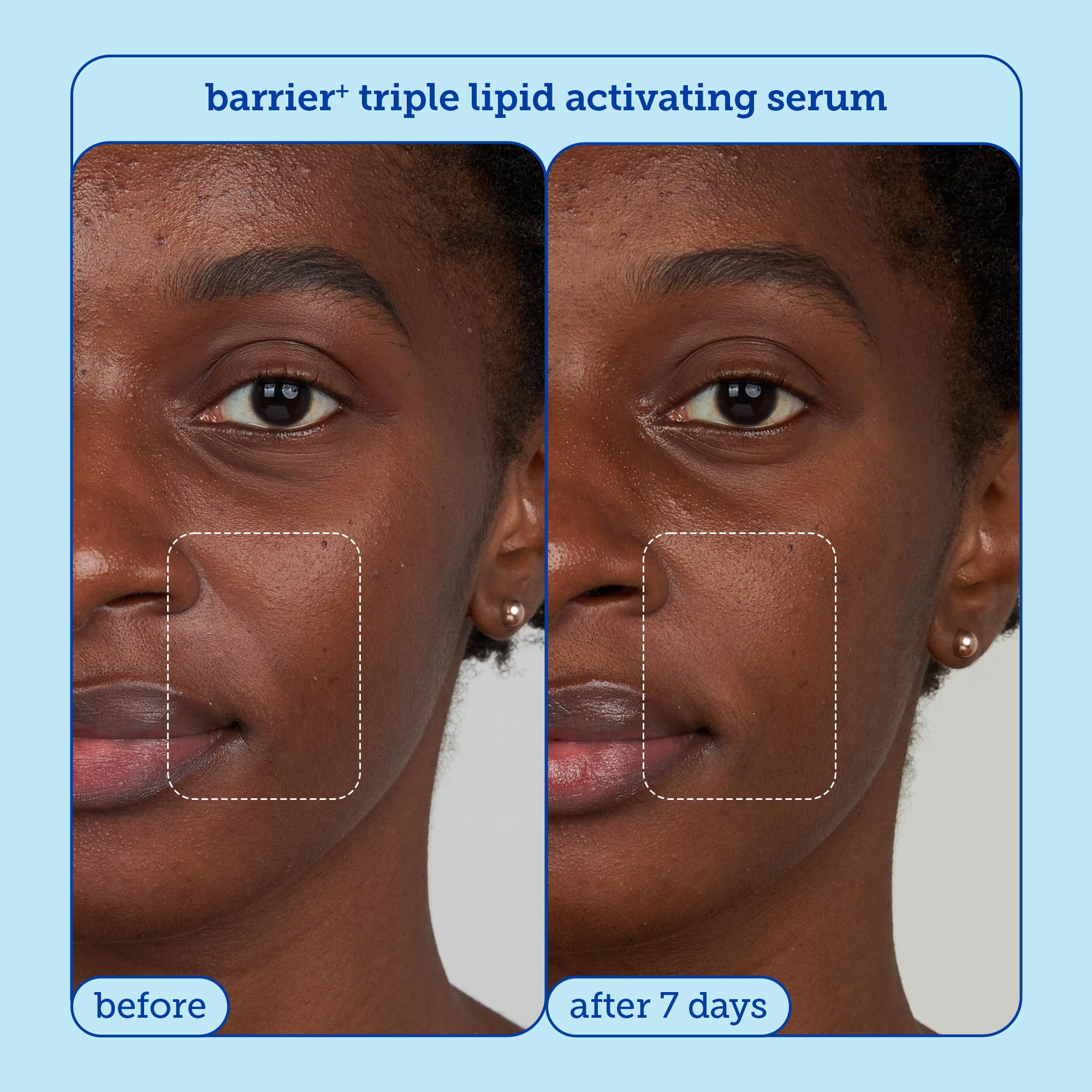 Skinfix Barrier+ Firm Trio