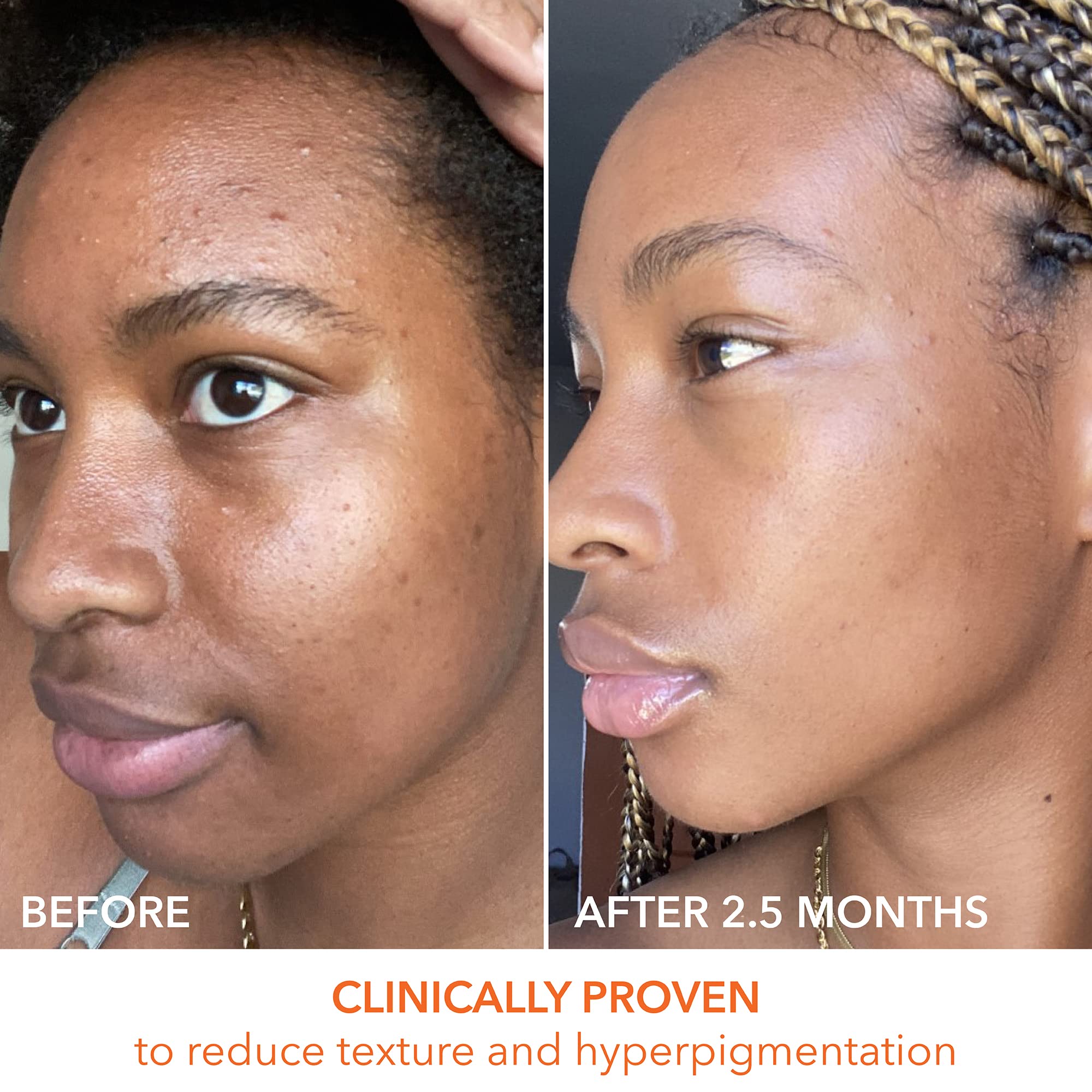 Dr Dennis Gross Alpha Beta Universal Daily Peel