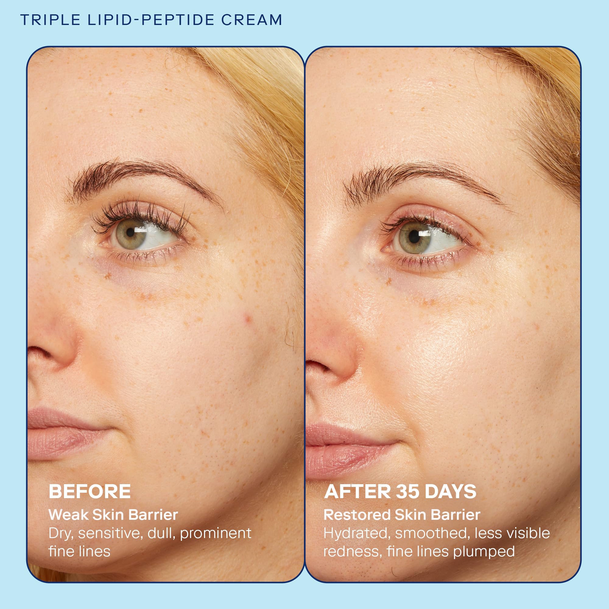 Skinfix Barrier+ Triple Lipid-Peptide Cream & Barrier+ Triple Lipid-Boost 360 Eye