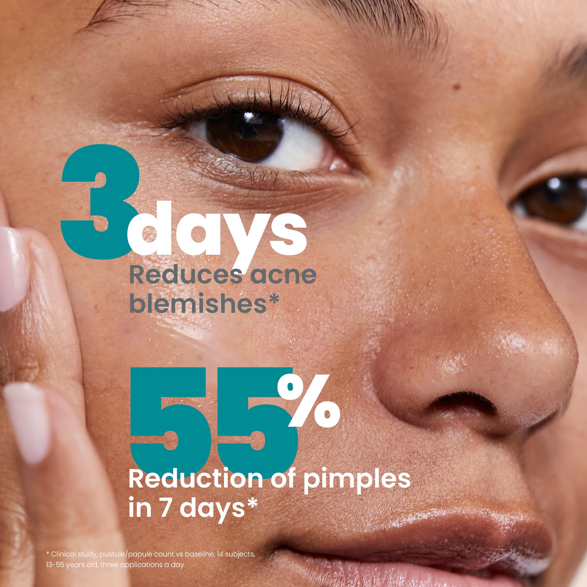 Avène Cleanance Acne Medicated Clearing Treatment