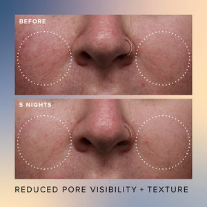 Farmacy Face Exfoliator Serum